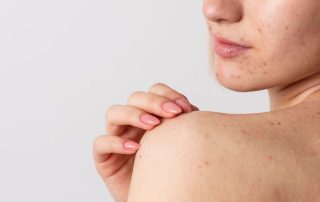 regno unito problematiche della pelle