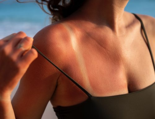 Tanmaxxing: la tintarella estrema sfida la cultura dell’SPF